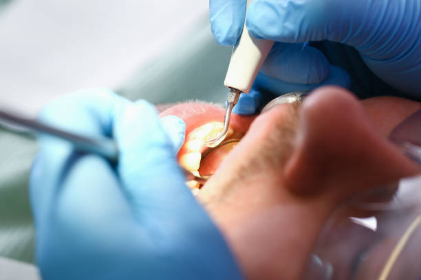Best Emergency Dental Care for Trauma or Injury in Chilhowie, VA