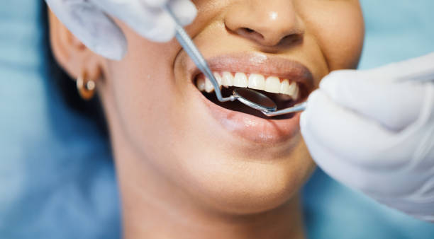 Best Pediatric Emergency Dentist in Chilhowie, VA